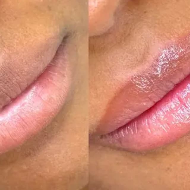 Lip Neutralizing at The Gleaux Lab/Charmed Beauty, LLC in West Monroe, LA